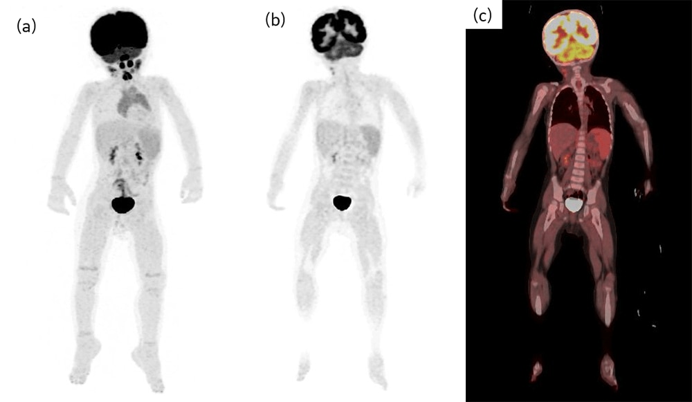 短時間検査を実施した小児症例